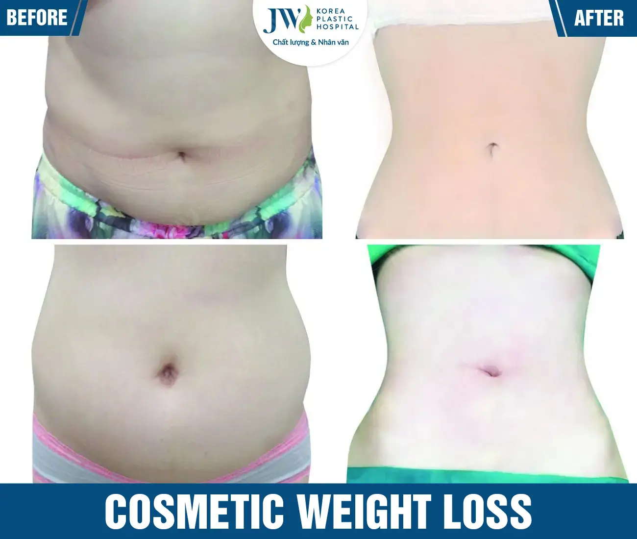 Cosmetic weight loss